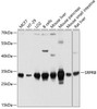 Cell Biology Antibodies 2 Anti-SRPRB Antibody CAB10591