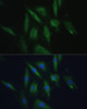 Cell Biology Antibodies 2 Anti-SRPRB Antibody CAB10591