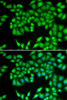 Cell Cycle Antibodies 1 Anti-MCM3 Antibody CAB1060