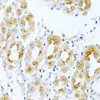 Cell Biology Antibodies 2 Anti-TDGF1 Antibody CAB1065