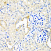 Cell Biology Antibodies 2 Anti-TDGF1 Antibody CAB1065