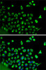Cell Biology Antibodies 2 Anti-CALR Antibody CAB1066