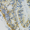 Metabolism Antibodies 1 Anti-SLC27A2 Antibody CAB1077