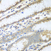 Cell Biology Antibodies 2 Anti-PDIA3 Antibody CAB1085