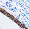 Cell Biology Antibodies 2 Anti-PPP1CB Antibody CAB1088