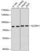 Cell Biology Antibodies 2 Anti-IL-22RA1 Antibody CAB10941