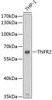 Cell Death Antibodies 1 Anti-TNFR2 Antibody CAB1095