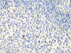 Cell Biology Antibodies 2 Anti-MTA2 Antibody CAB10980