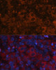 Cell Biology Antibodies 2 Anti-AFP Antibody CAB11013