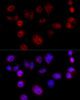 Cell Cycle Antibodies 1 Anti-Cyclin D1 Antibody CAB11022