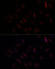 Cell Cycle Antibodies 1 Anti-BRCA1 Antibody CAB11034