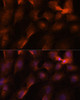 Cell Cycle Antibodies 1 Anti-BRCA1 Antibody CAB11034