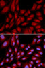 Cell Death Antibodies 1 Anti-BAG1 Antibody CAB1104