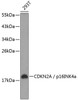 Cell Biology Antibodies 2 Anti-CDKN2A / p16INK4a Antibody CAB11058