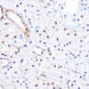 Cell Biology Antibodies 2 Anti-DNMT3B Antibody CAB11079
