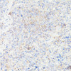 Cell Biology Antibodies 2 Anti-IGFBP1 Antibody CAB11109