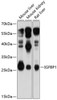 Cell Biology Antibodies 2 Anti-IGFBP1 Antibody CAB11109