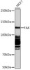 Cardiovascular Antibodies Anti-FAK Antibody CAB11131