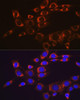 Cardiovascular Antibodies Anti-FAK Antibody CAB11131