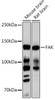 Cardiovascular Antibodies Anti-FAK Antibody CAB11131