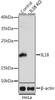 KO Validated Antibodies 1 Anti-IL-18 Antibody CAB1115KO Validated