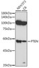 KO Validated Antibodies 1 Anti-PTEN Antibody CAB11193KO Validated
