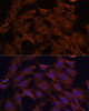 Cell Death Antibodies 1 Anti-SQSTM1 Antibody CAB11246