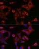 Cell Death Antibodies 1 Anti-SQSTM1 / p62 Antibody CAB11247