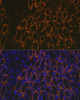 Cell Biology Antibodies 2 Anti-AMACR Antibody CAB1130