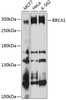 Cell Cycle Antibodies 1 Anti-BRCA1 Antibody CAB11318