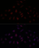 Cell Cycle Antibodies 1 Anti-BRCA1 Antibody CAB11318