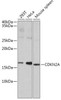 Cell Biology Antibodies 2 Anti-CDKN2A / p16INK4a Antibody CAB11337