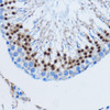 Cell Death Antibodies 1 Anti-DDIT3 / CHOP Antibody CAB11346