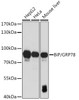 Cell Biology Antibodies 2 Anti-BiP/GRP78 Antibody CAB11366