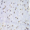 Immunology Antibodies 1 Anti-Lyn Antibody CAB11385