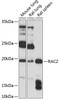 Cell Biology Antibodies 2 Anti-RAC2 Antibody CAB1139