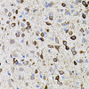 Cell Biology Antibodies 2 Anti-MMP9 Antibody CAB11391