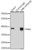 KO Validated Antibodies 1 Anti-IkBAlpha Antibody CAB11397KO Validated