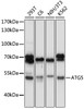 Cell Death Antibodies 1 Anti-ATG5 Antibody CAB11427