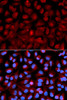 Autophagy Antibodies Anti-HDAC6 Antibody CAB11429
