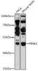Autophagy Antibodies Anti-PINK1 Antibody CAB11435