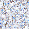 Cell Biology Antibodies 2 Anti-CTGF Antibody CAB11456