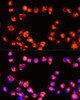 Cell Death Antibodies 1 Anti-MLKL Antibody CAB11458