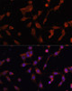 Immunology Antibodies 1 Anti-LAMP1 Antibody CAB11468