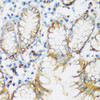 Cell Biology Antibodies 2 Anti-E-Cadherin Antibody CAB11492