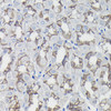 KO Validated Antibodies 1 Anti-Beta-Catenin Antibody CAB11512KO Validated