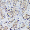 KO Validated Antibodies 1 Anti-Beta-Catenin Antibody CAB11512KO Validated