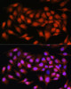 Epigenetics and Nuclear Signaling Antibodies 1 Anti-BCL3 Antibody CAB11582