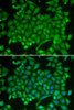 Cell Cycle Antibodies 1 Anti-RAB11A Antibody CAB1167