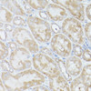 Cell Biology Antibodies 2 Anti-RPS18 Antibody CAB11687